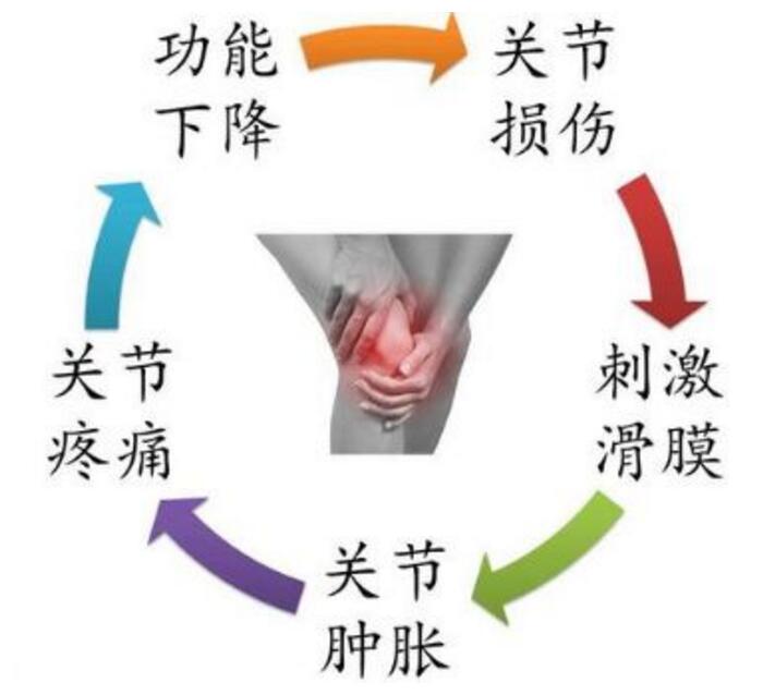 痛风患者千万别以抽关节积液的方式,缓解疼痛! 痛风患者千万别以抽关节积液的方式,缓解疼痛!