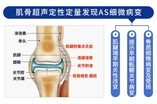 欧美新一代MSUS肌骨超声技术 欧美新一代MSUS肌骨超声技术