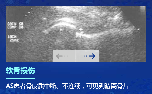 欧美新一代MSUS肌骨超声技术 欧美新一代MSUS肌骨超声技术