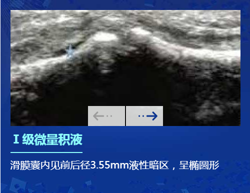 欧美新一代MSUS肌骨超声技术
