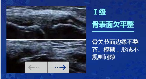 欧美新一代MSUS肌骨超声技术