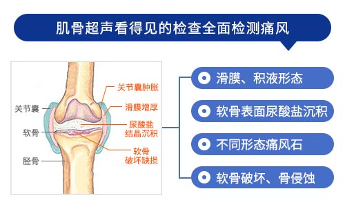 肌骨超声技术检查 肌骨超声技术