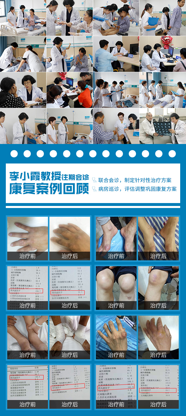 MDT多学科|北京一号难求特需专家联合会诊9月20日开诊 MDT多学科|北京一号难求特需专家联合会诊9月20日开诊